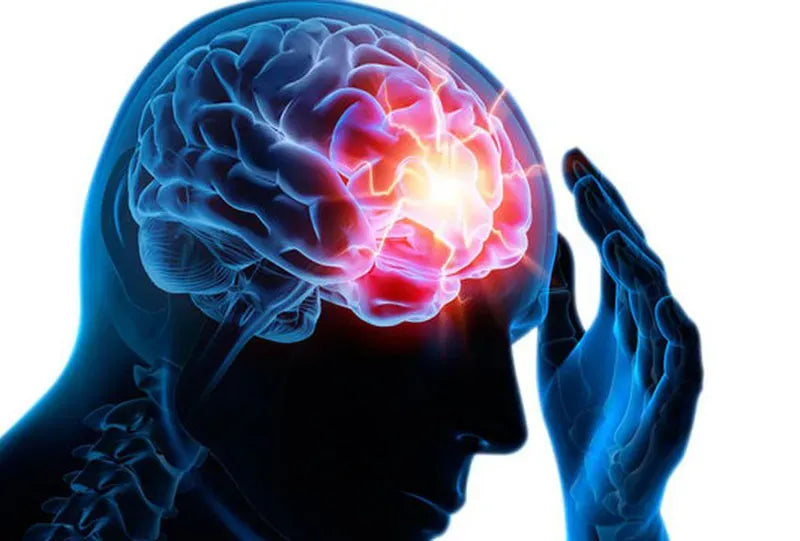 Traitement de l'épilepsie par le CBD : Tout ce que vous devez savoir